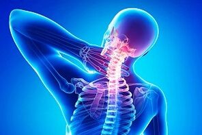 dor nas costas como sintoma de osteocondrose