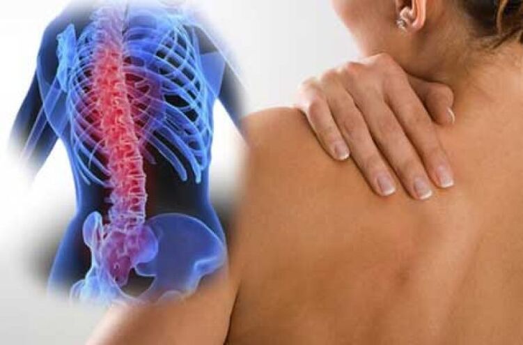 Durante uma exacerbação da osteocondrose da coluna torácica, ocorre dor no dorso