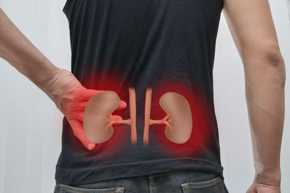 inflamação dos rins como causa de dor nas costas