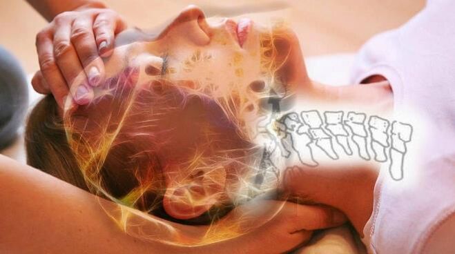 Alterações degenerativas nos discos vertebrais para osteocondrose cervical