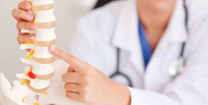 Osteocondrose é uma doença espinhal