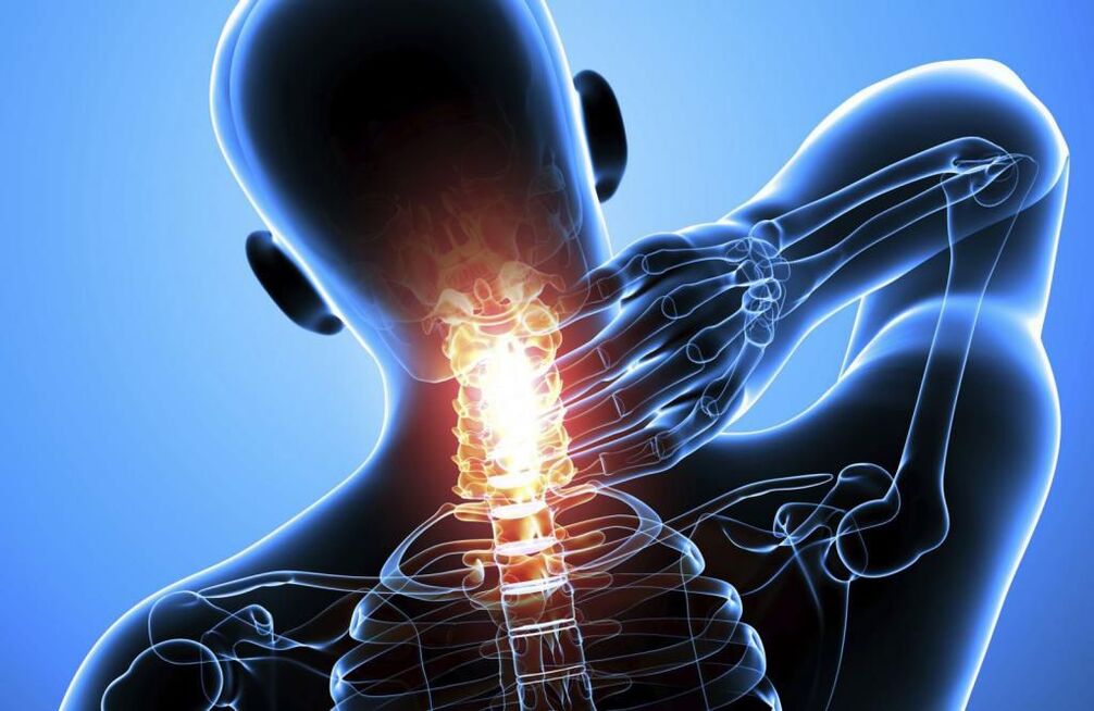 Osteocondrose da coluna cervical